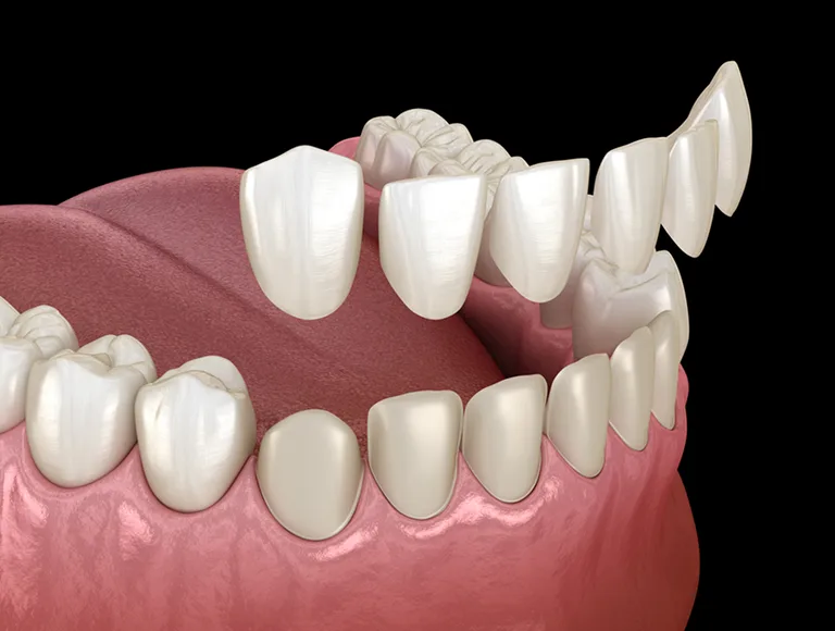 A Specialist-Led Implant Approach