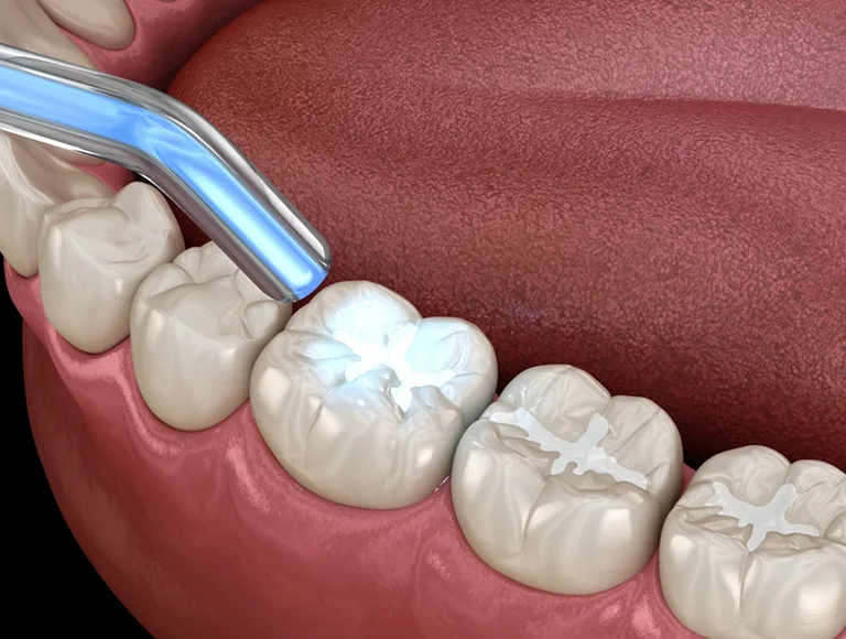 Expert-Led Restorative Dentistry