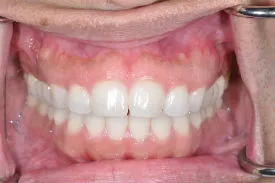 before cosmetic dentistry - Las Vegas, NV