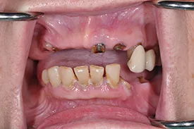 before cosmetic dentistry - Las Vegas, NV