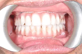 after cosmetic dentistry - Las Vegas, NV