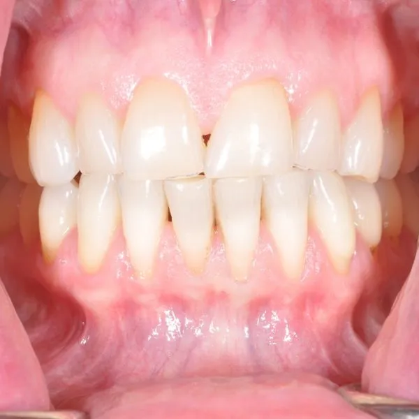 after surgical grafting - Las Vegas, NV