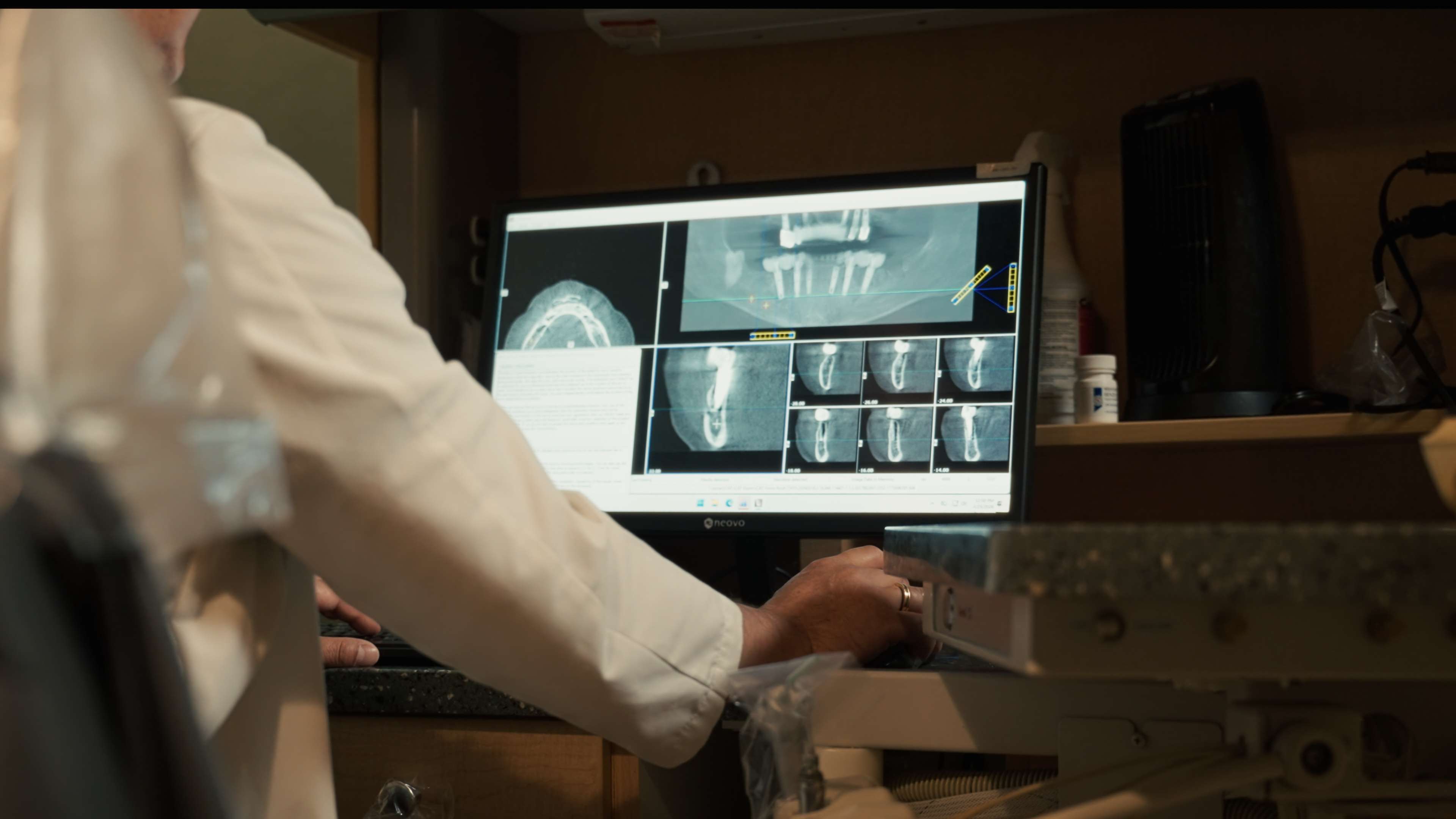What Is Laser Dentistry?